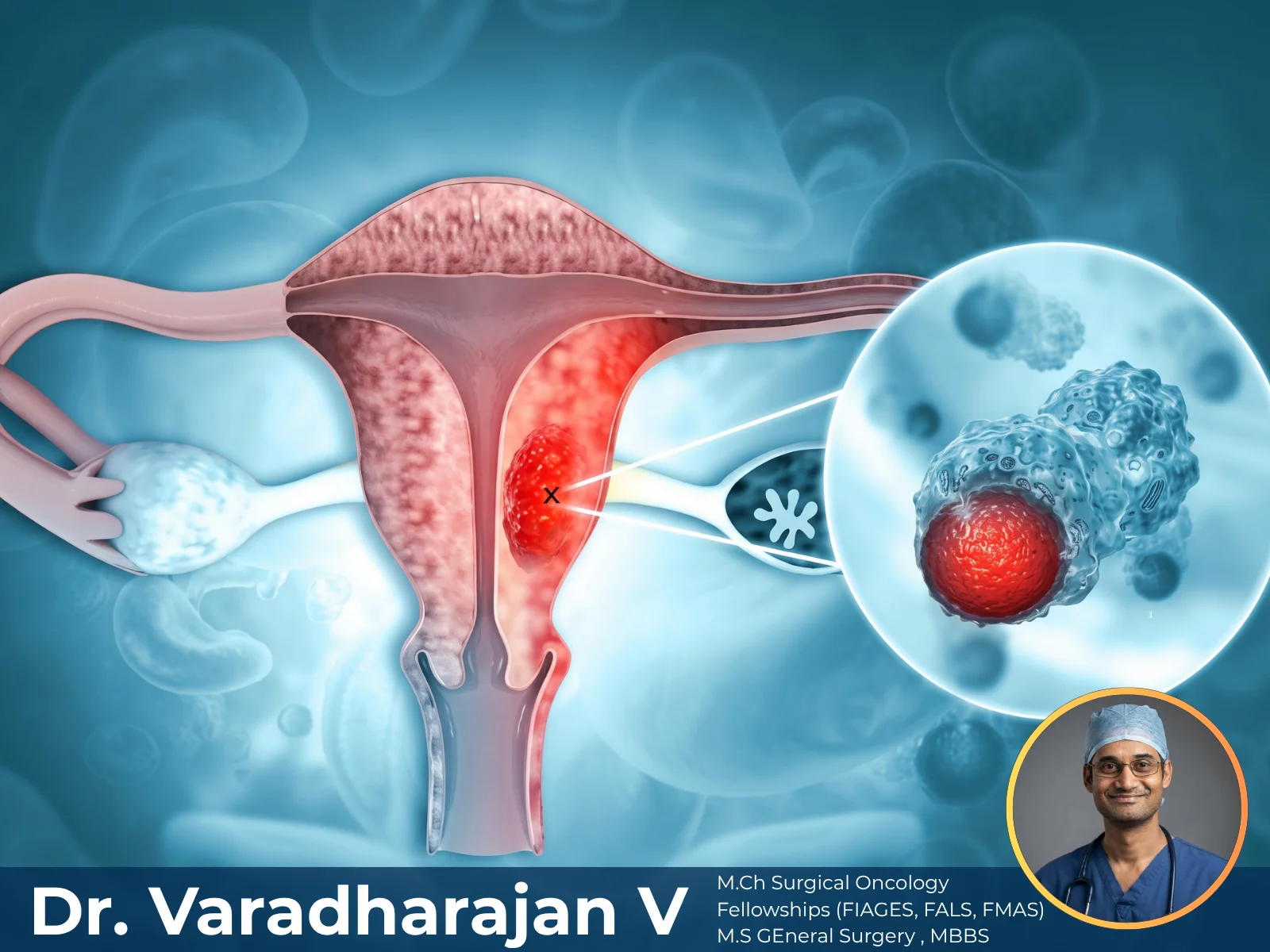 Gynaecological Malignancies