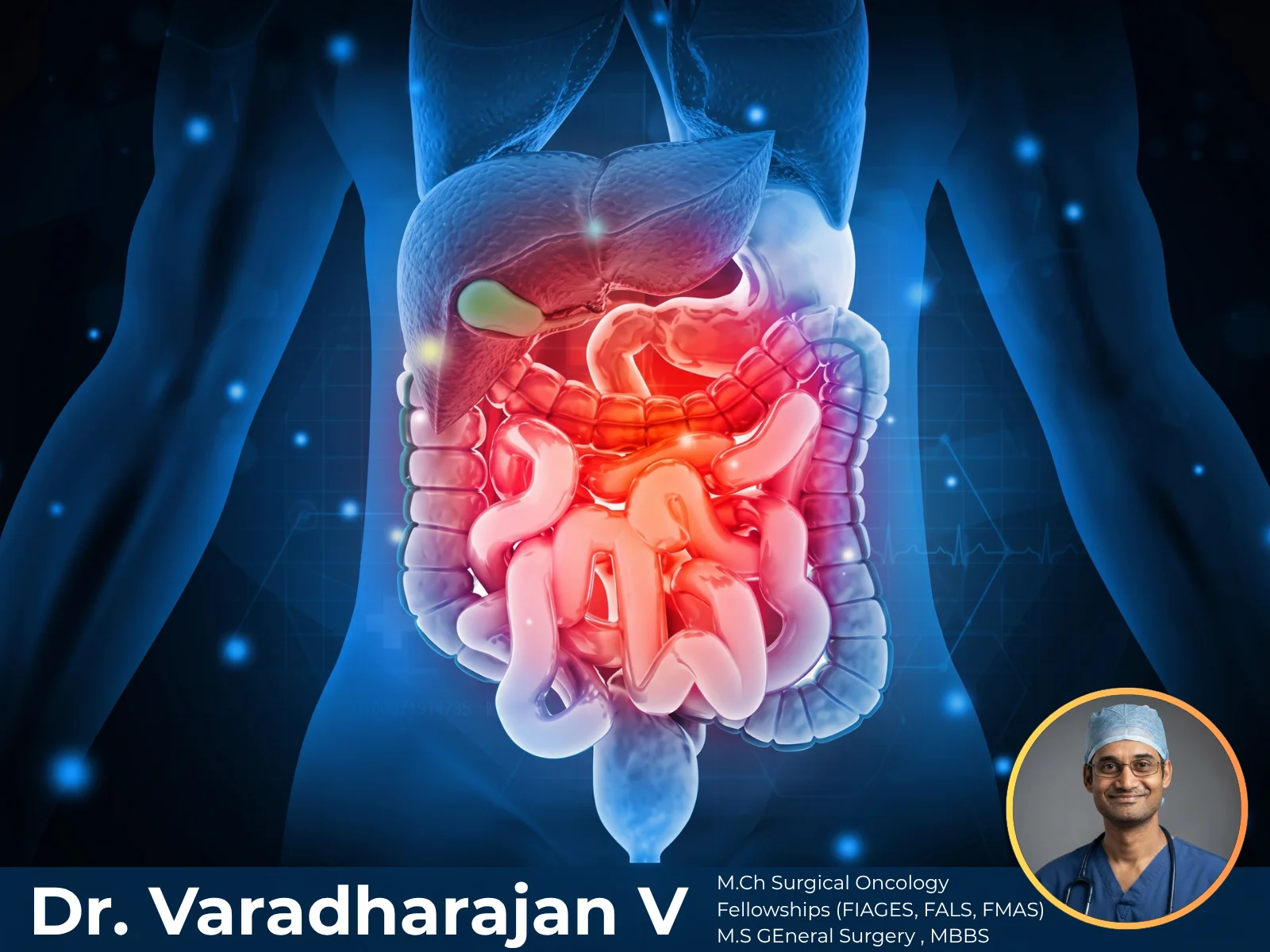 Retroperitoneal Tumor Surgery