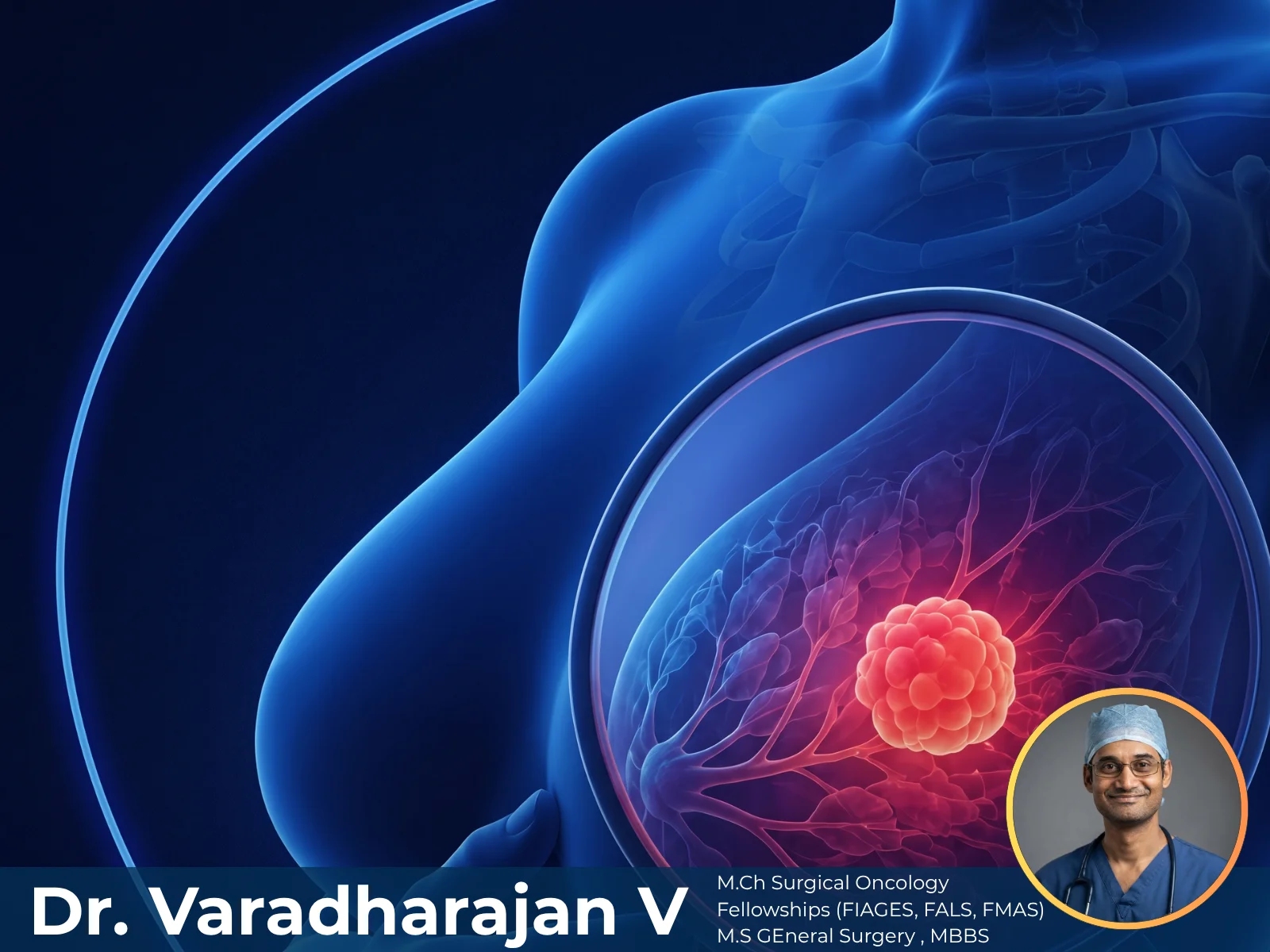 Breast Oncoplasty