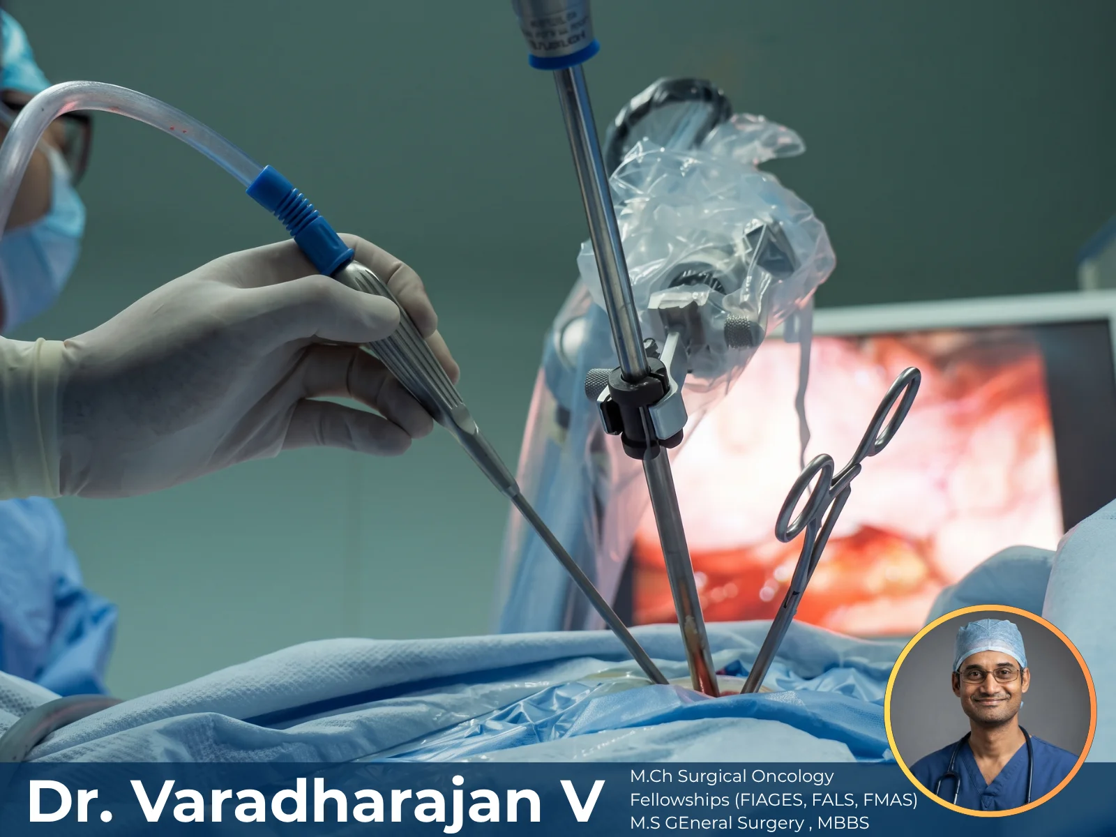 VATS Lobectomy